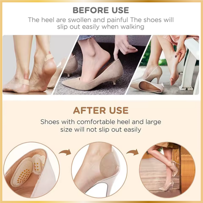 Coussinets Antidérapants pour Talons – Confort et Protection