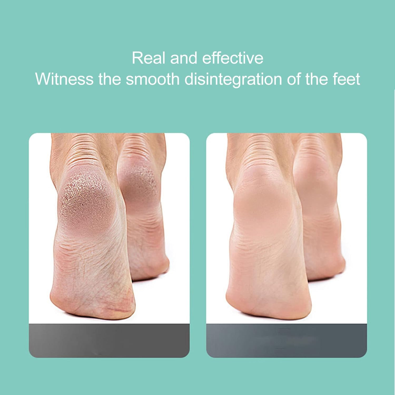 Appareil électrique pour les pieds, dissolvant de callosités et de talons, meulage USB, Machines de pédicure, outil de soins des pieds pour femmes et hommes