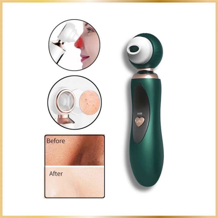 Kit Anti Points Noirs Outils de Nettoyage Visage